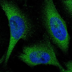 KLHL28 Antibody, Novus Biologicals:Antibodies:Primary Antibodies